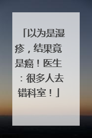 以为是湿疹，结果竟是癌！医生：很多人去错科室！